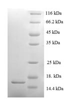 SDS-PAGE