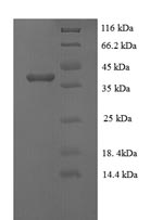 SDS-PAGE