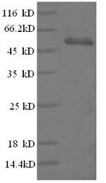 SDS-PAGE