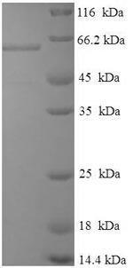 SDS-PAGE