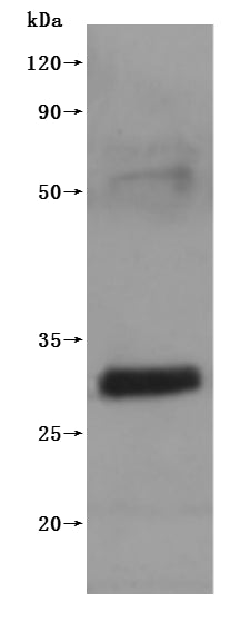Western Blot