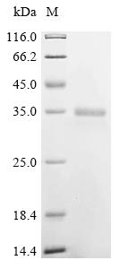 SDS-PAGE