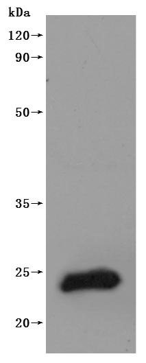 Western Blot