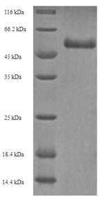 SDS-PAGE