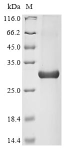 SDS-PAGE