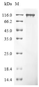 SDS-PAGE