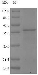 SDS-PAGE