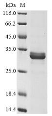 SDS-PAGE