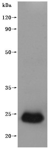 Western Blot