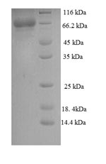 SDS-PAGE