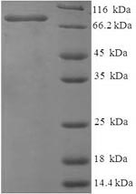 SDS-PAGE