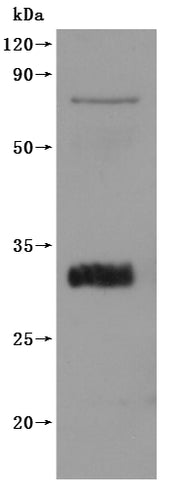 Western Blot