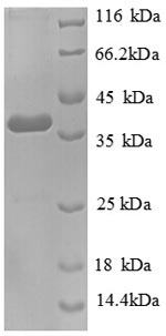 SDS-PAGE