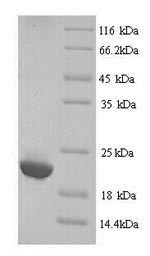 SDS-PAGE