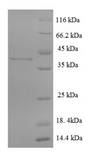 SDS-PAGE