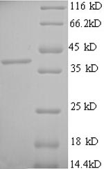 SDS-PAGE