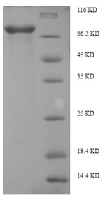 SDS-PAGE