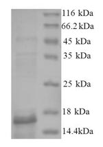 SDS-PAGE