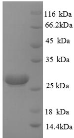 SDS-PAGE