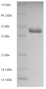 SDS-PAGE