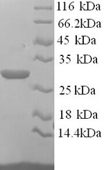 SDS-PAGE