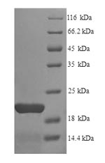 SDS-PAGE