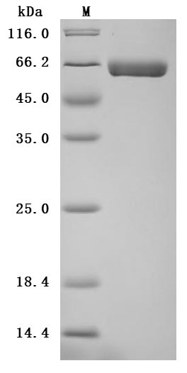 SDS-PAGE