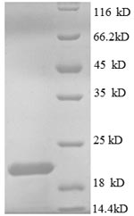 SDS-PAGE