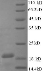 SDS-PAGE