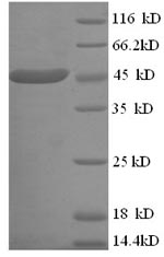 SDS-PAGE