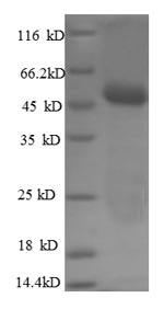 SDS-PAGE