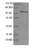 SDS-PAGE