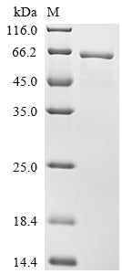 SDS-PAGE