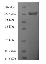 SDS-PAGE