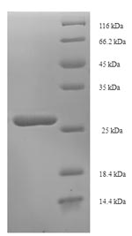 SDS-PAGE