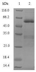 SDS-PAGE