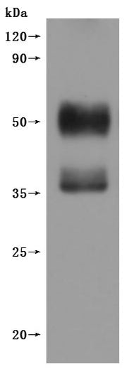 Western Blot