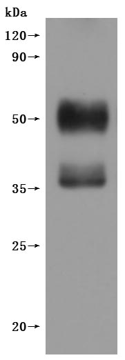 Western Blot