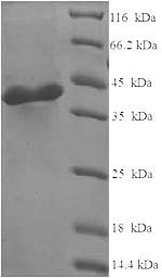 SDS-PAGE