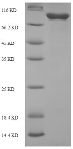 SDS-PAGE