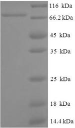 SDS-PAGE