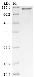 SDS-PAGE