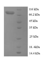 SDS-PAGE