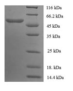 SDS-PAGE