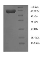 SDS-PAGE