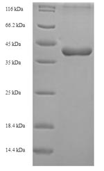 SDS-PAGE