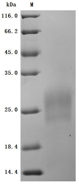 SDS-PAGE