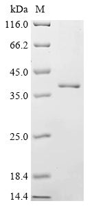 SDS-PAGE