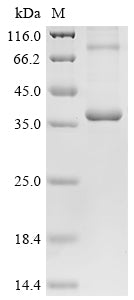 SDS-PAGE