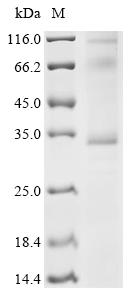 SDS-PAGE